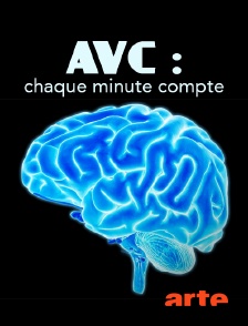 AVC : chaque minute compte