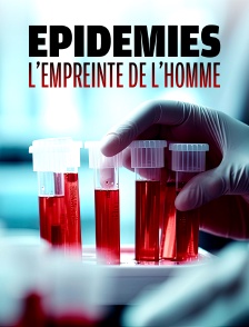 Epidémies, l'empreinte de l'homme