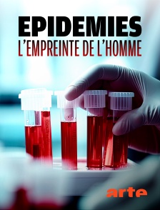 Arte - Epidémies, l'empreinte de l'homme