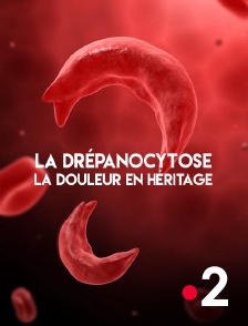 France 2 - La drépanocytose, la douleur en héritage