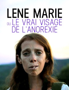 Lene Marie ou le vrai visage de l'anorexie
