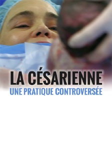 La césarienne : une pratique controversée