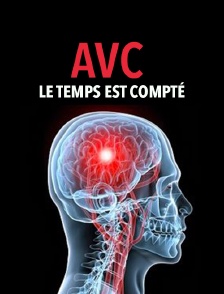AVC, le temps est compté