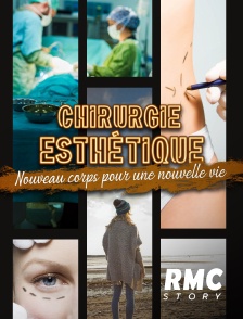 RMC Story - Chirurgie esthétique : nouveau corps pour une nouvelle vie