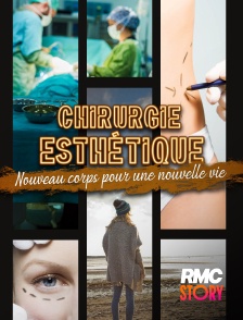 RMC Story - Chirurgie esthétique : nouveau corps pour une nouvelle vie