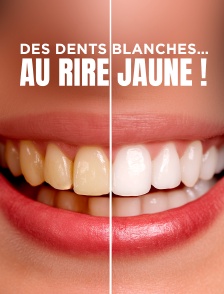 Des dents blanches... au rire jaune !