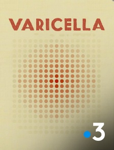 Varicella