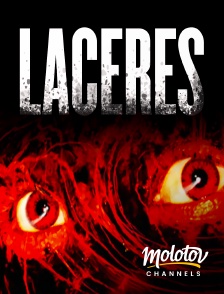 Molotov Channels - Lacérés