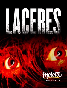 Molotov channels - Lacérés