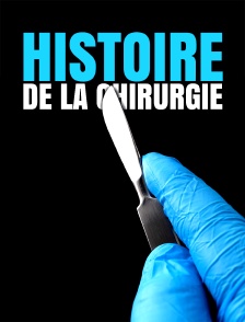 Histoire de la chirurgie