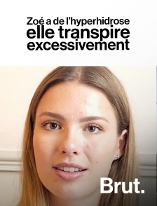 Brut - Zoé a de l’hyperhidrose, elle transpire excessivement