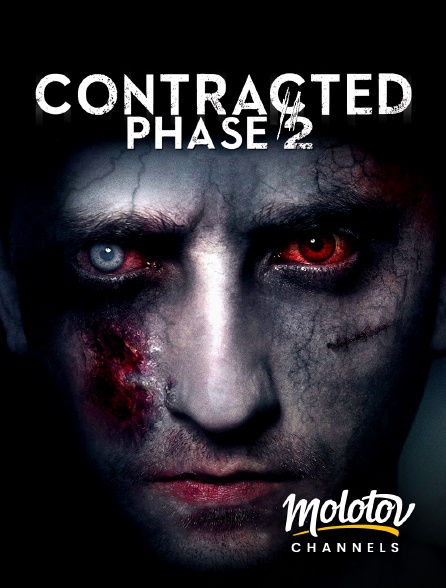 Molotov channels - Contracted Phase II