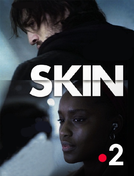 France 2 - Skin