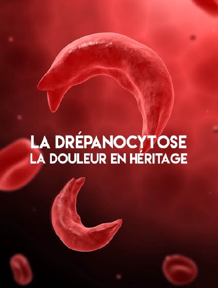 La drépanocytose, la douleur en héritage
