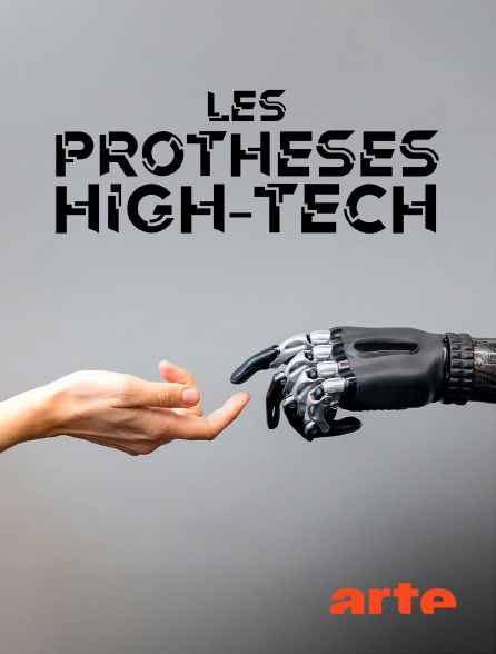 Arte - Les prothèses high-tech : Réparer le corps et l'esprit