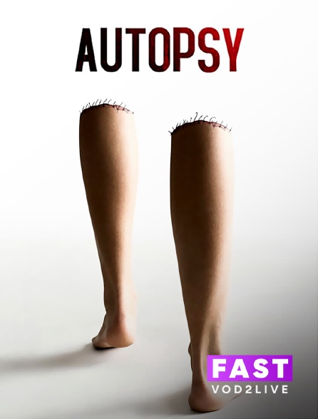 Molotov Channels TEST FAST - Autopsy