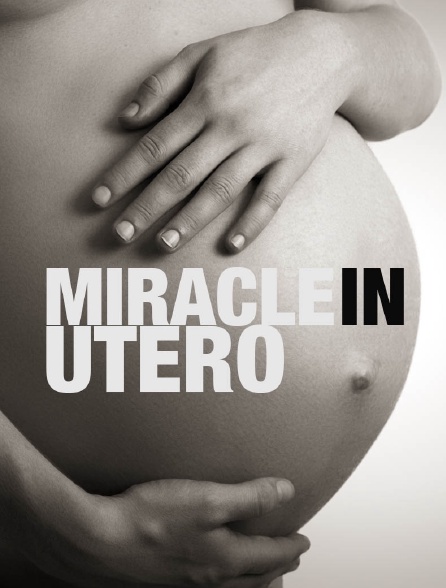 Miracles in utero