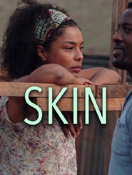 Skin
