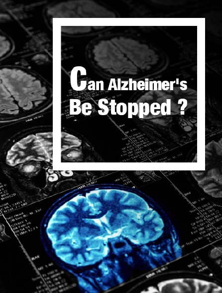 La maladie d'Alzheimer