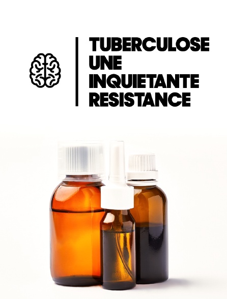 Tuberculose, une inquiétante résistance