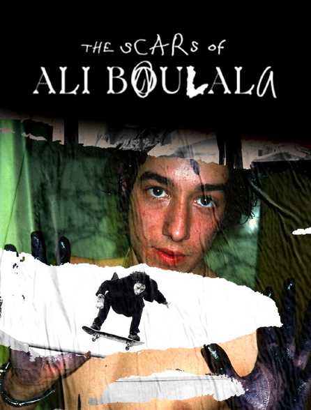 The scars of Ali Boulala