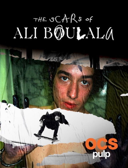 OCS Pulp - The scars of Ali Boulala