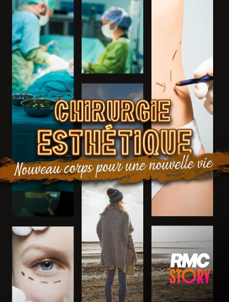 RMC Story - Chirurgie esthétique : nouveau corps pour une nouvelle vie en replay