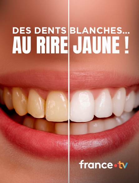 france.tv - Des dents blanches... au rire jaune !