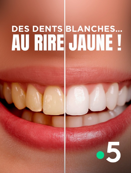 France 5 - Des dents blanches... au rire jaune !