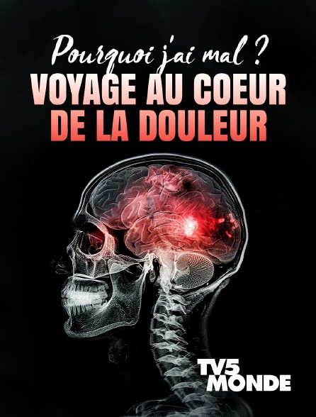 TV5MONDE - Pourquoi j'ai mal ? Voyage au coeur de la douleur