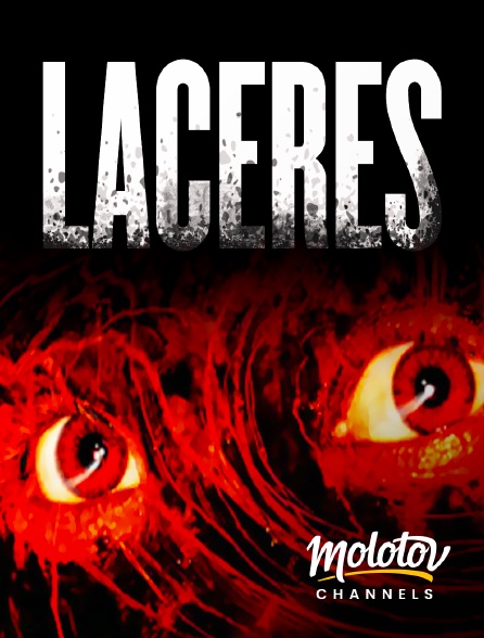Molotov Channels - Lacérés