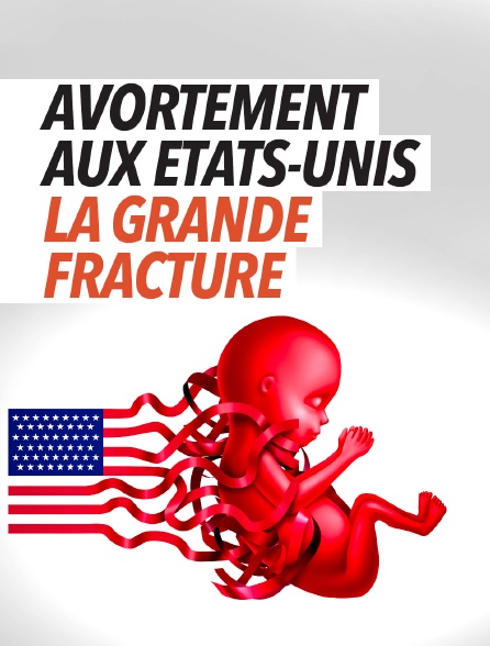 Avortement aux Etats-Unis : la grande fracture