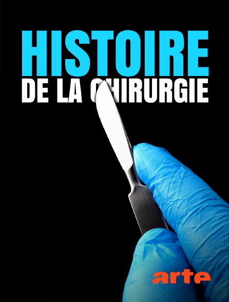 Arte - Histoire de la chirurgie