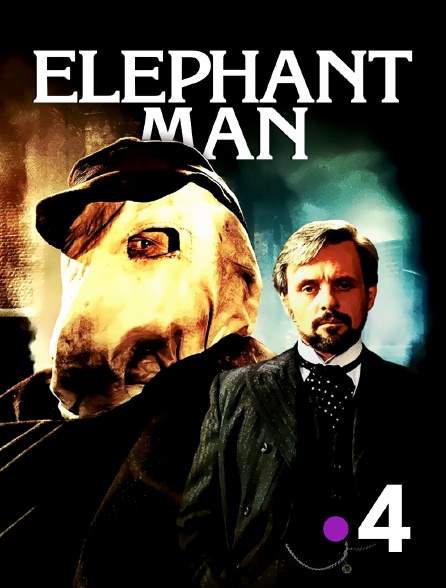 France 4 - Elephant Man
