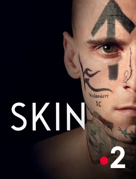 France 2 - Skin