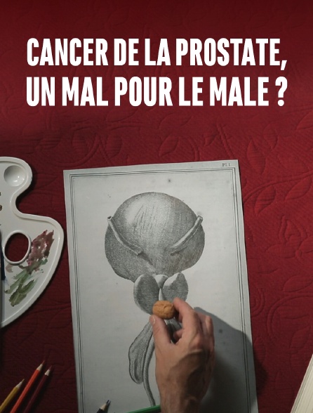 Cancer de la prostate, faut-il opérer à tout prix ?