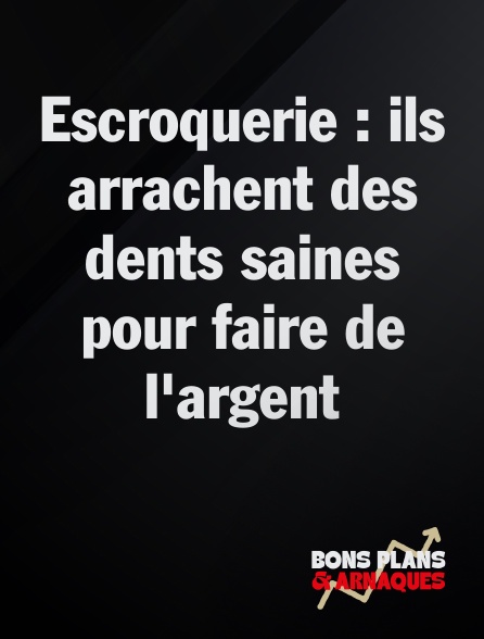 Bons plans et arnaques - Escroquerie : ils arrachent des dents saines pour faire de l'argent
